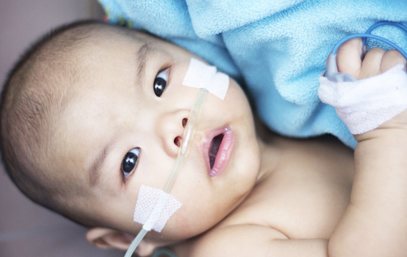 婴幼儿敏感肌医用胶带