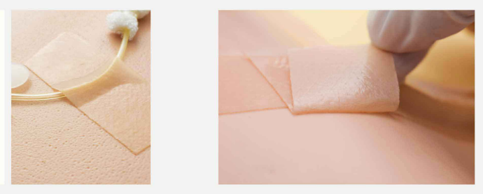 医用胶带亲肤性好